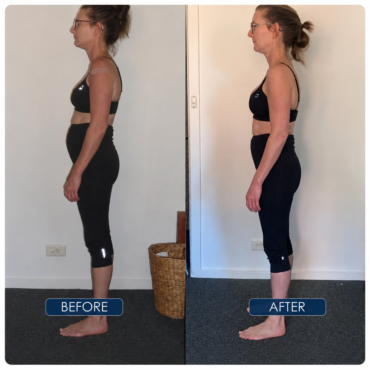 Instant Posture Corrector