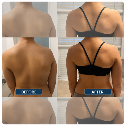Instant Posture Corrector